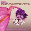 Endometrioza - Zdrowie Kobiety