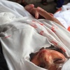 Chris Hedges on Israel's plan to depopulate Gaza | The Marc Steiner Show