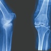 Episode 27 – Overcoming arthritis: Scripps Research Magazine