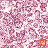 Placenta Research May Help Explain Pregnancy Loss
