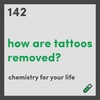 How are tattoos removed?