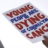 Millennial? Gen Z? It may be time for colorectal cancer screening