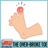 91: The Over-broke Toe