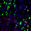 Maternal immune response dulls male rats’ social radar