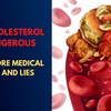 High Cholesterol is Dangerous & 5 More Medical Myths & Lies