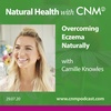 Overcoming Eczema Naturally with Camille Knowles