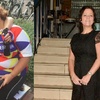 Emma has lost 7 stone and had excess skin removed at a discounted price