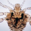 Die Tierdocs: Laus ist neugierig