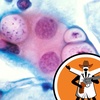 Chlamydia