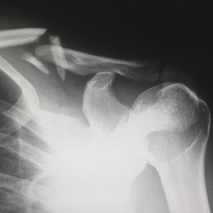 Episode 12, Part 3 - Physical Injuries and Self Care