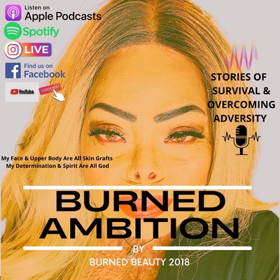 Burned Ambition by Burned Beauty 2018 - A Burn Survivors Podcast 